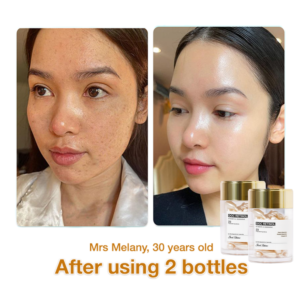 Doc Retinol Justshine