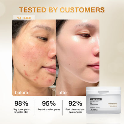 ACNE TREATMENT COMBO JUST SKIN