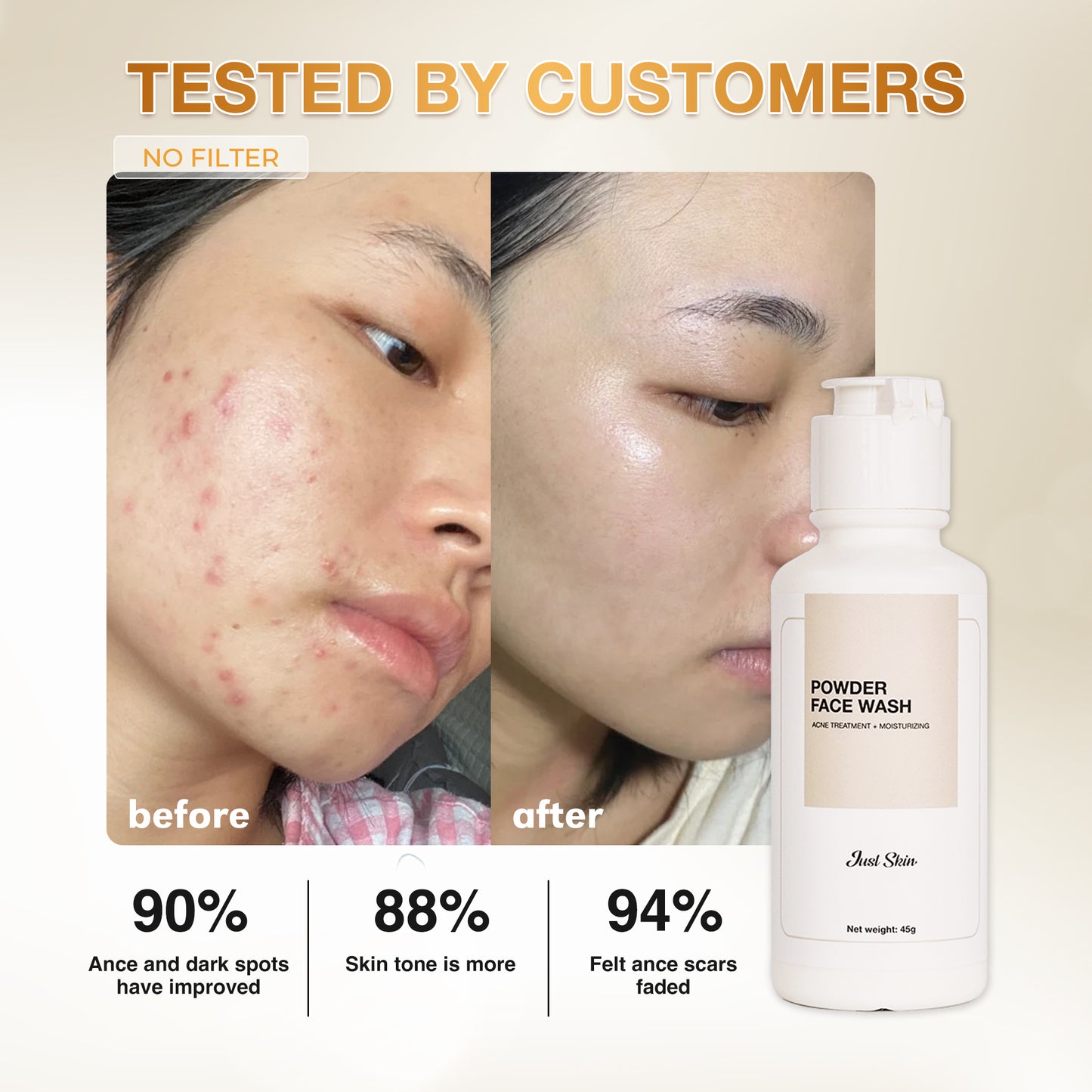 ACNE TREATMENT COMBO JUST SKIN