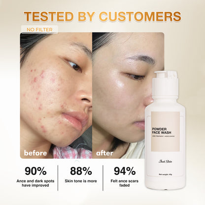 ACNE TREATMENT COMBO JUST SKIN