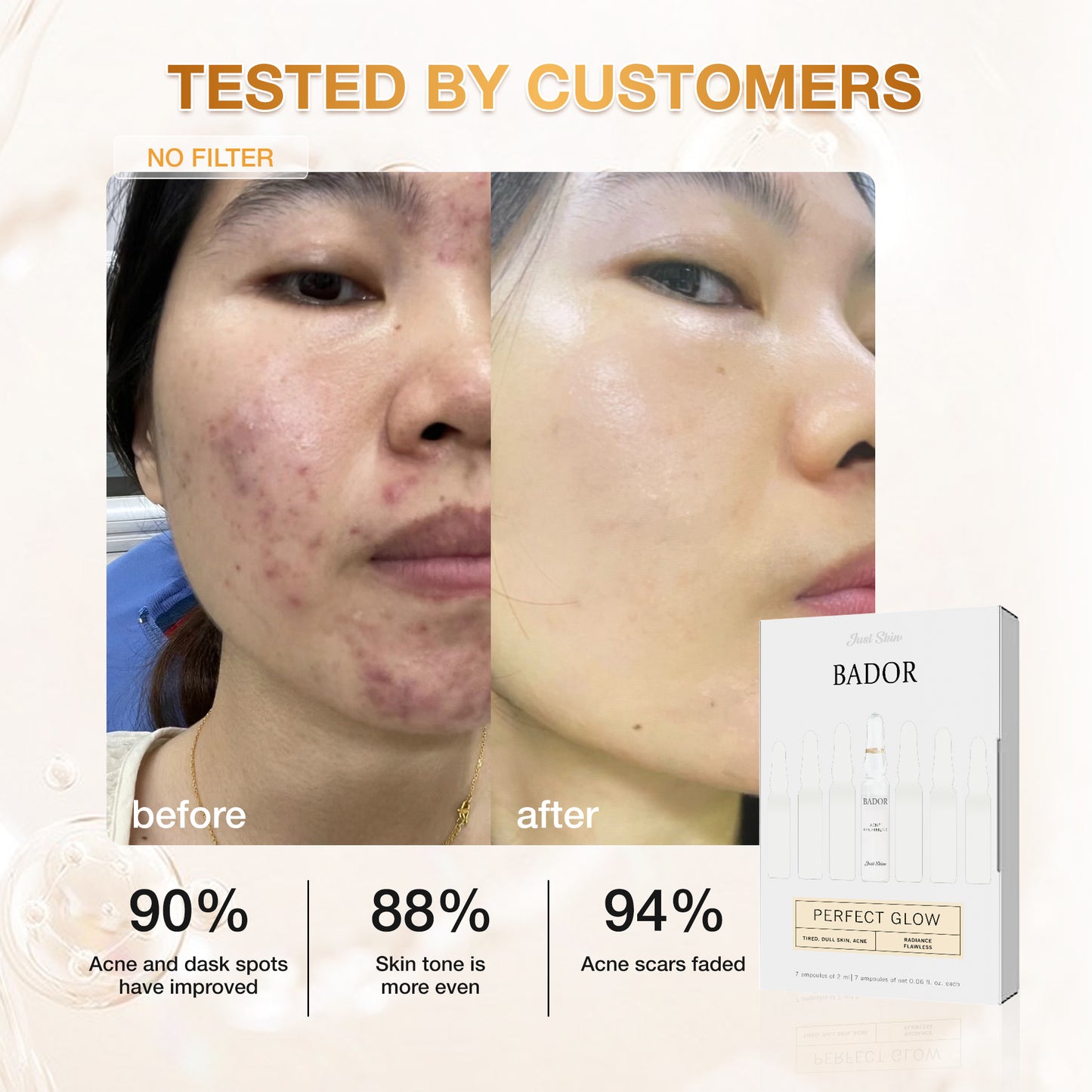 Set Bador Justskin V1