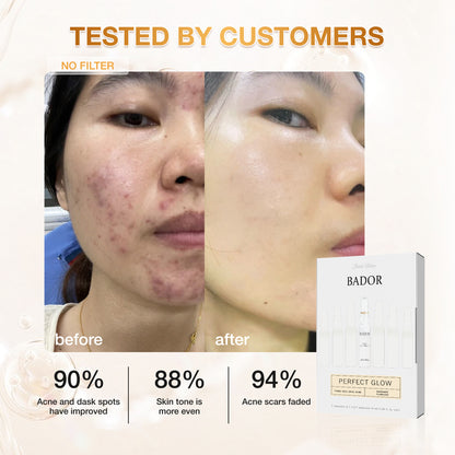 Set Bador Justskin V1