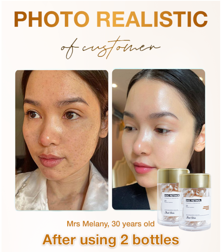 Doc Retinol Justskin V1