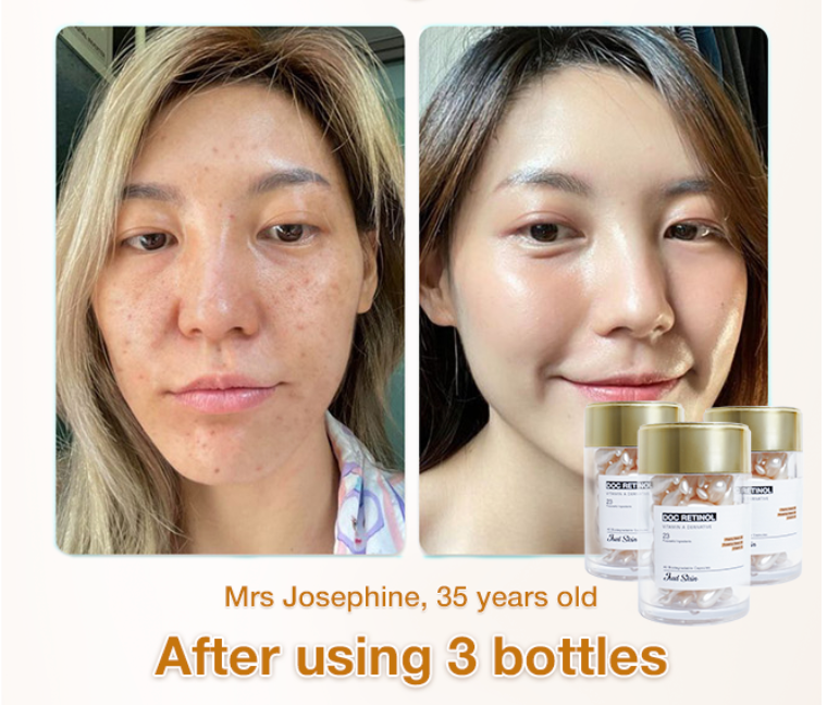 Doc Retinol Justskin V1